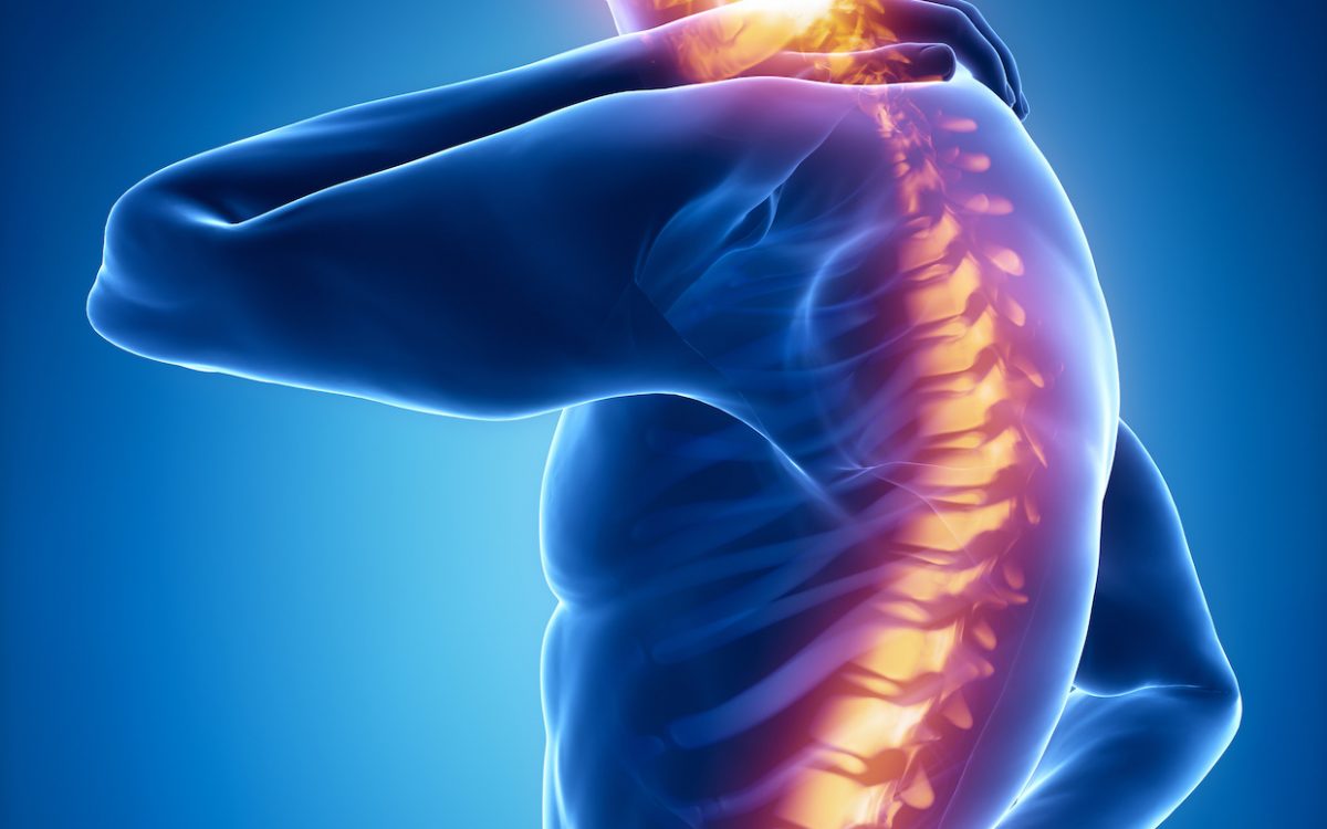 10 (falsi) miti sul mal di schiena lombare